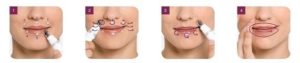 Nightly Lip Treatment | Hoe te gebruiken